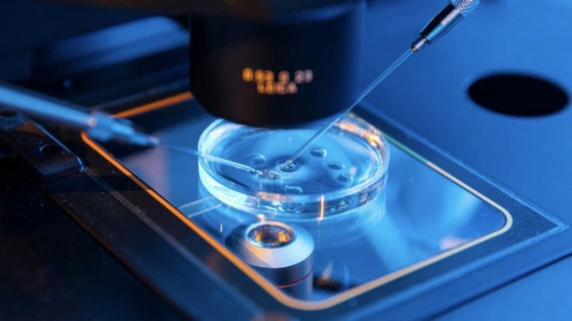 Mikroenjeksiyon (ICSI, Intrasitoplazmik Sperm Enjeksiyonu)