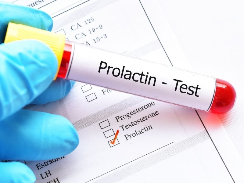 Prolaktin Yüksekliği